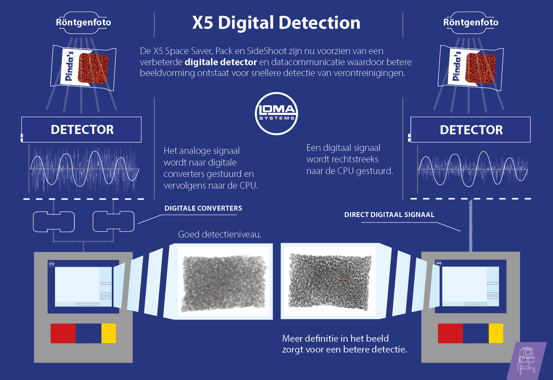Loma Systems Digital Detection for Xray